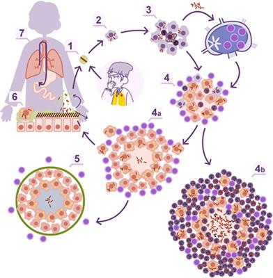 What We Have Learned and What We Have Missed in Tuberculosis Pathophysiology for a New Vaccine Design: Searching for the “Pink Swan”